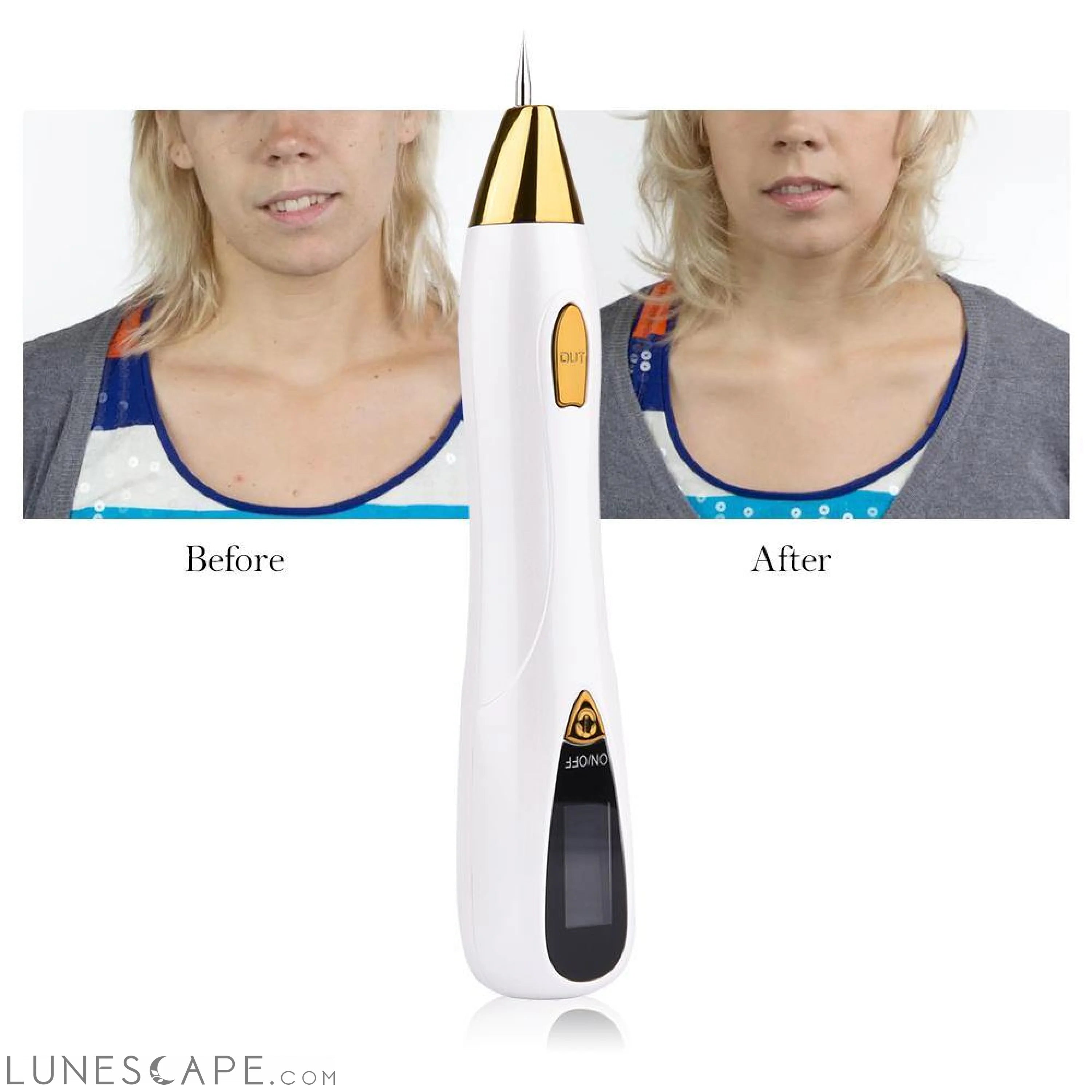 Laser Mole and Freckle Removal Pen LUNESCAPE