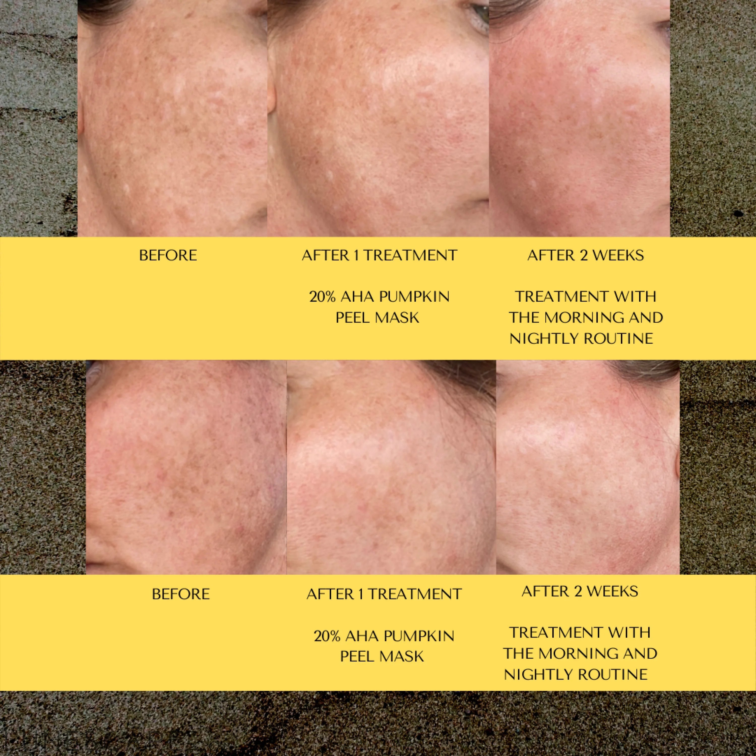 Vitamin C Toner LUNESCAPE